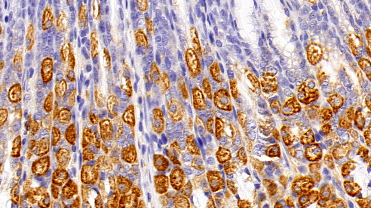 Polyclonal Antibody to Virus Induced Signaling Adapter (VISA)