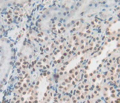 Polyclonal Antibody to YY1 Associated Factor 2 (YAF2)