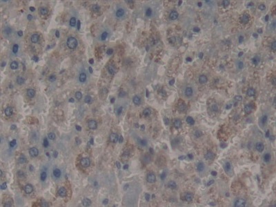 Polyclonal Antibody to Microfibrillar Associated Protein 2 (MFAP2)