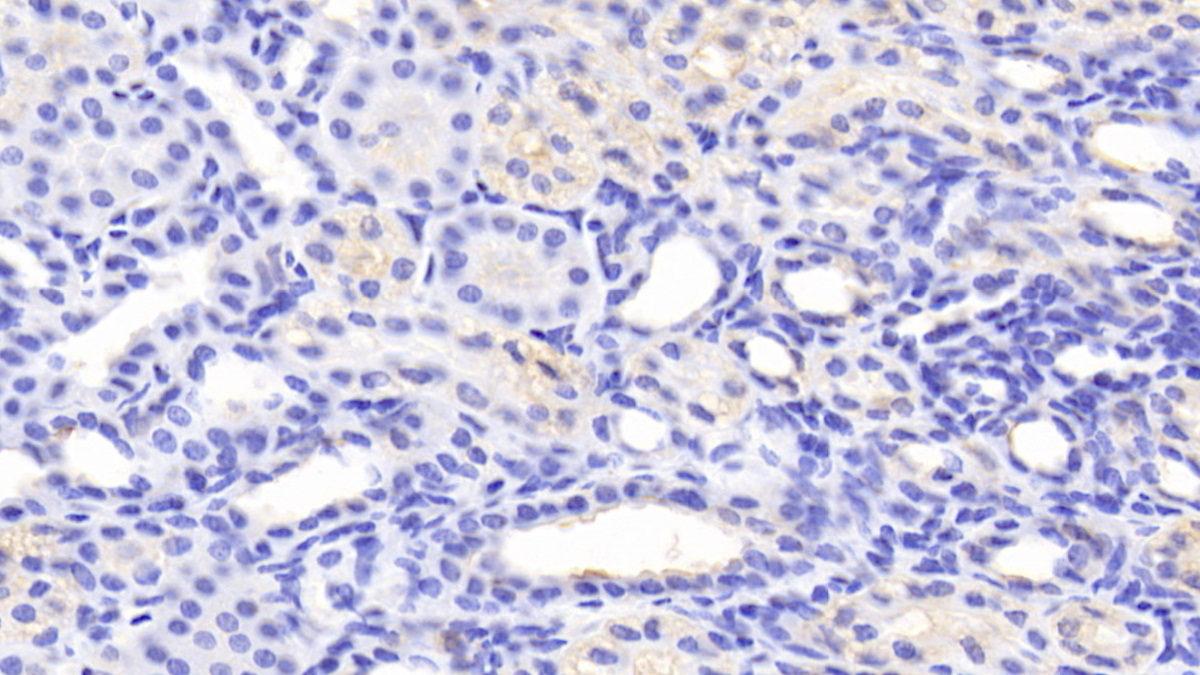 Polyclonal Antibody to Mitofusin 1 (MFN1)