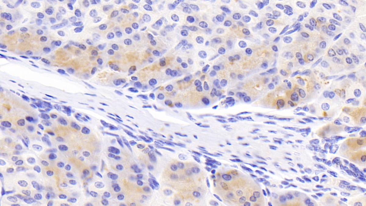 Polyclonal Antibody to Molybdenum Cofactor Synthesis 1 (MOCS1)