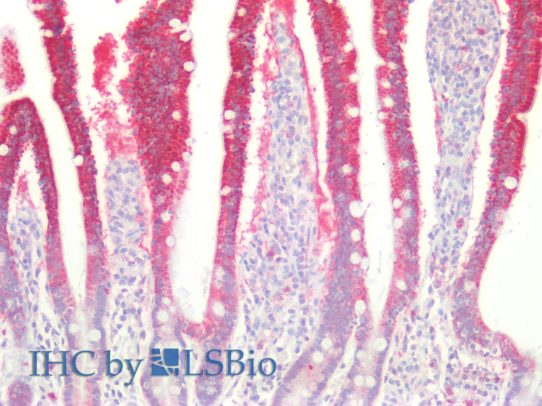 Polyclonal Antibody to 3-Mercaptopyruvate Sulfurtransferase (MST)