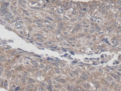 Polyclonal Antibody to Mitochondrial Ribosomal Protein L1 (MRPL1)