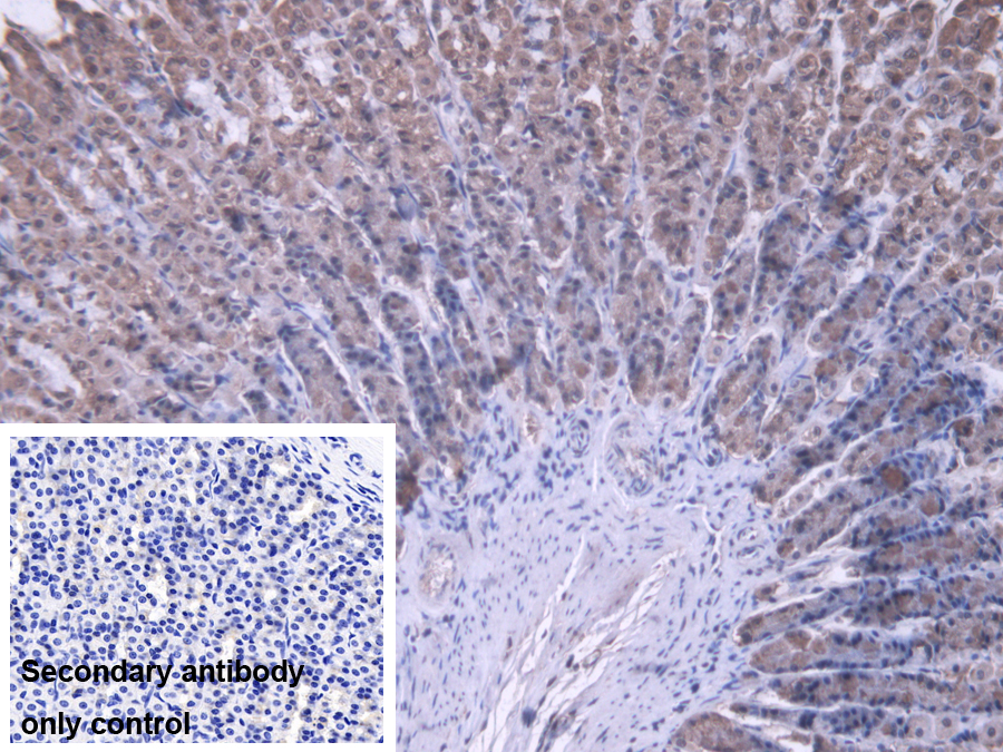 Polyclonal Antibody to Mitochondrial Ribosomal Protein L1 (MRPL1)