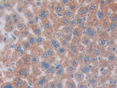 Polyclonal Antibody to Metastasis Associated Protein 1 (MTA1)