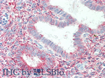 Polyclonal Antibody to Metal Regulatory Transcription Factor 1 (MTF1)