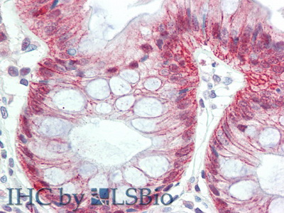 Polyclonal Antibody to Metal Regulatory Transcription Factor 1 (MTF1)