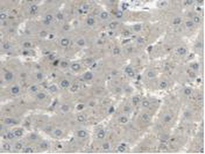 Polyclonal Antibody to Mitochondrial Tumor Suppressor 1 (MTUS1)