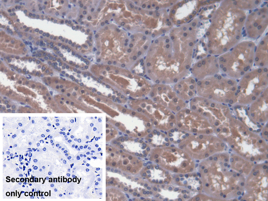 Polyclonal Antibody to Metaxin 1 (MTX1)