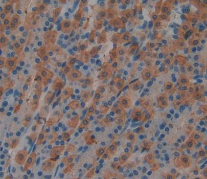 Polyclonal Antibody to Megakaryocyte Associated Tyrosine Kinase (MATK)