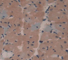 Polyclonal Antibody to Microsomal Triglyceride Transfer Protein (MTTP)