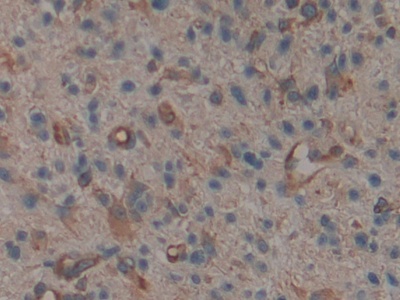 Polyclonal Antibody to Moesin (MSN)