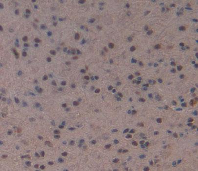 Polyclonal Antibody to Myocyte Specific Enhancer Factor 2A (MEF2A)