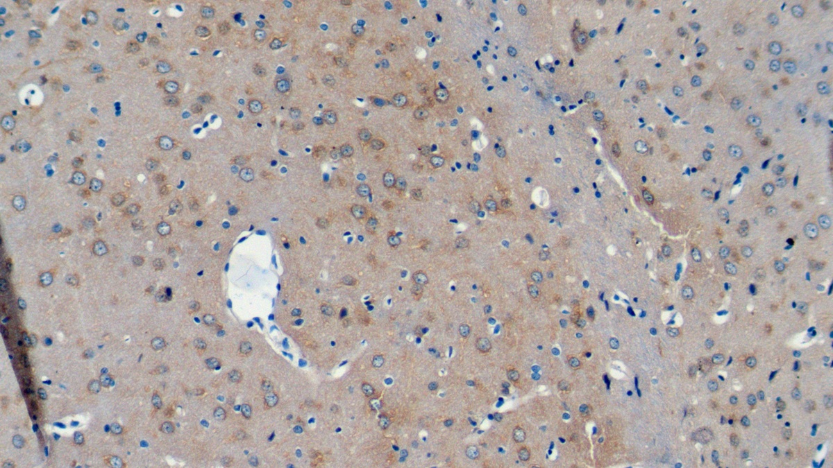 Polyclonal Antibody to Neurochondrin (NCDN)