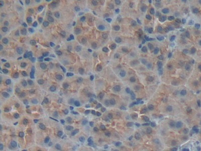 Polyclonal Antibody to Insulin Like Growth Factor Binding Protein 5 (IGFBP5)