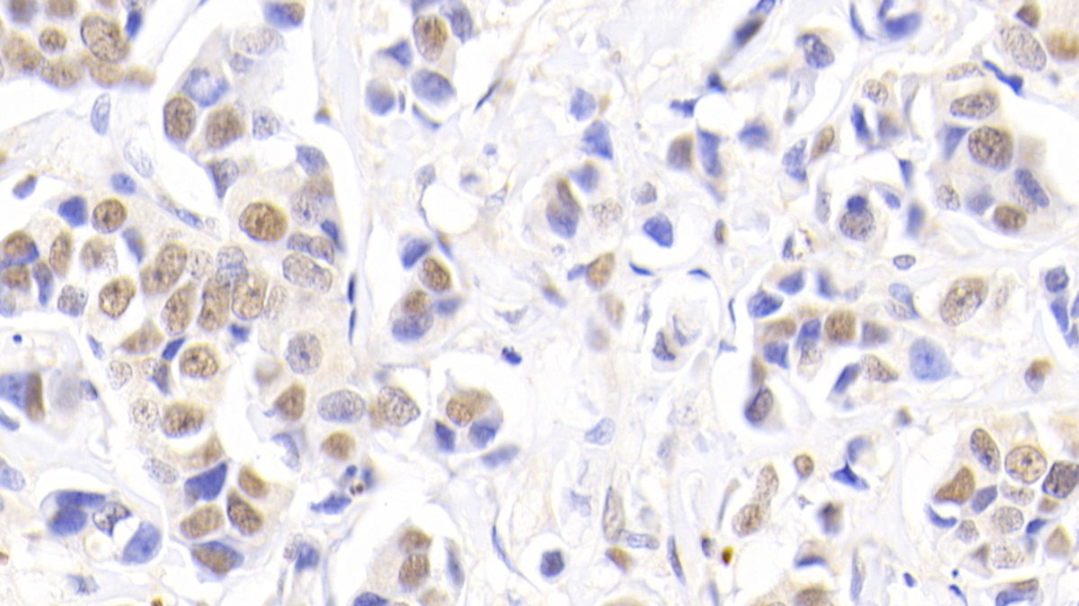 Polyclonal Antibody to Nucleophosmin 1 (NPM1)