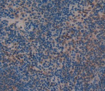 Polyclonal Antibody to Neutrophil Cytosolic Factor 1 (NCF1)