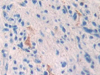 Polyclonal Antibody to Nicastrin (NCSTN)