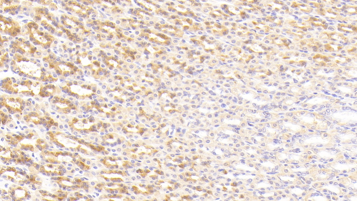 Polyclonal Antibody to Nicastrin (NCSTN)