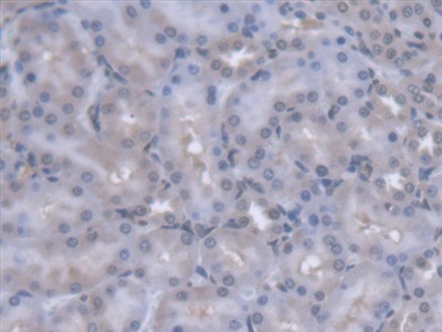 Polyclonal Antibody to Purine Nucleoside Phosphorylase (PNP)