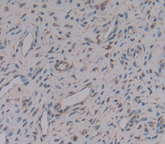 Polyclonal Antibody to Osteoglycin (OGN)