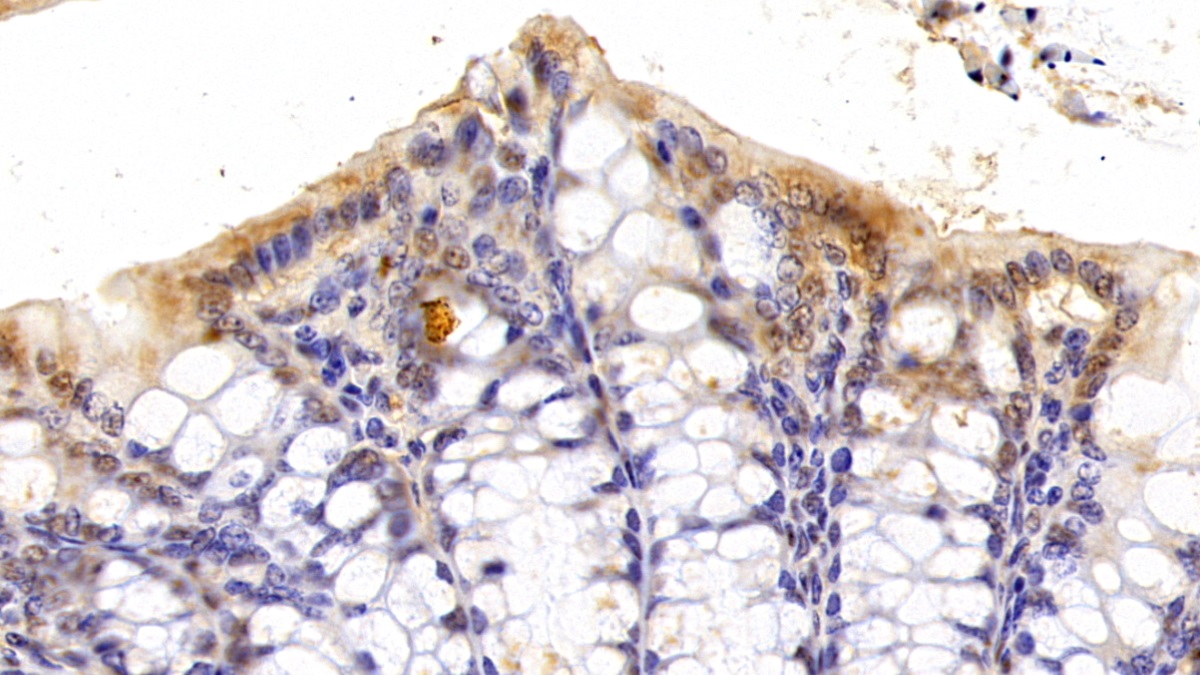 Polyclonal Antibody to Olfactomedin 3 (OLFM3)