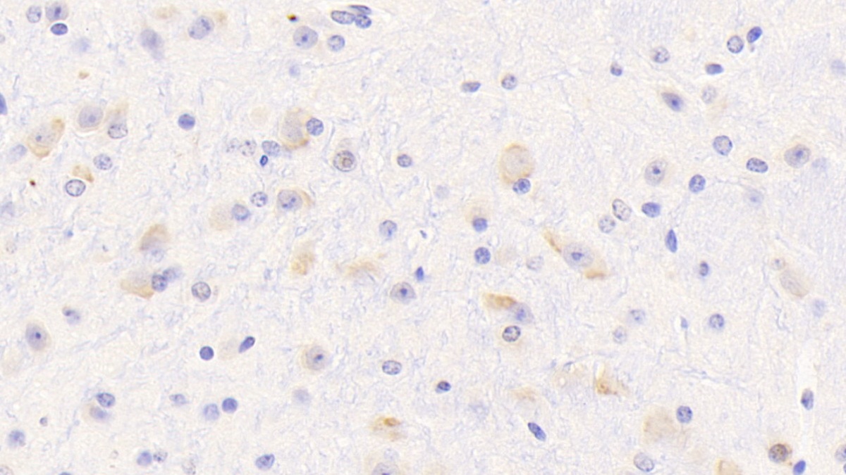 Polyclonal Antibody to Oligophrenin 1 (OPHN1)