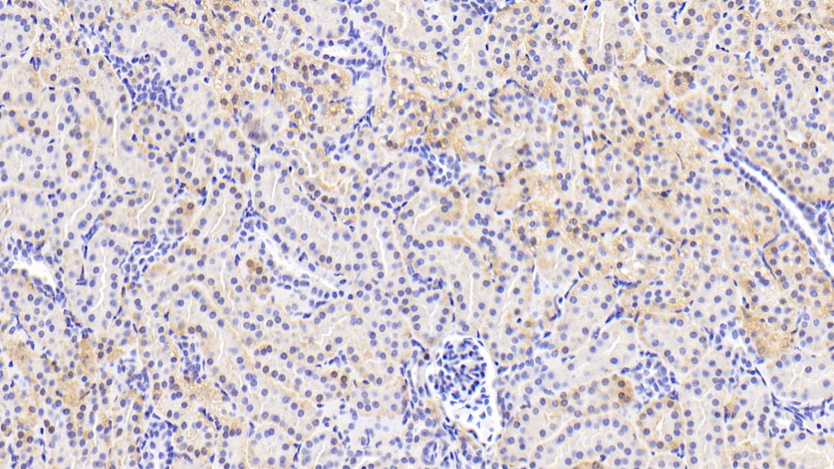 Polyclonal Antibody to Osteopetrosis Associated Transmembrane Protein 1 (OSTM1)