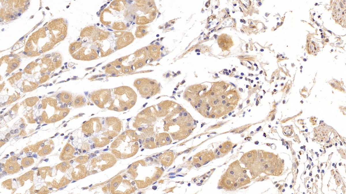 Polyclonal Antibody to Optic Atrophy 3 (OPA3)