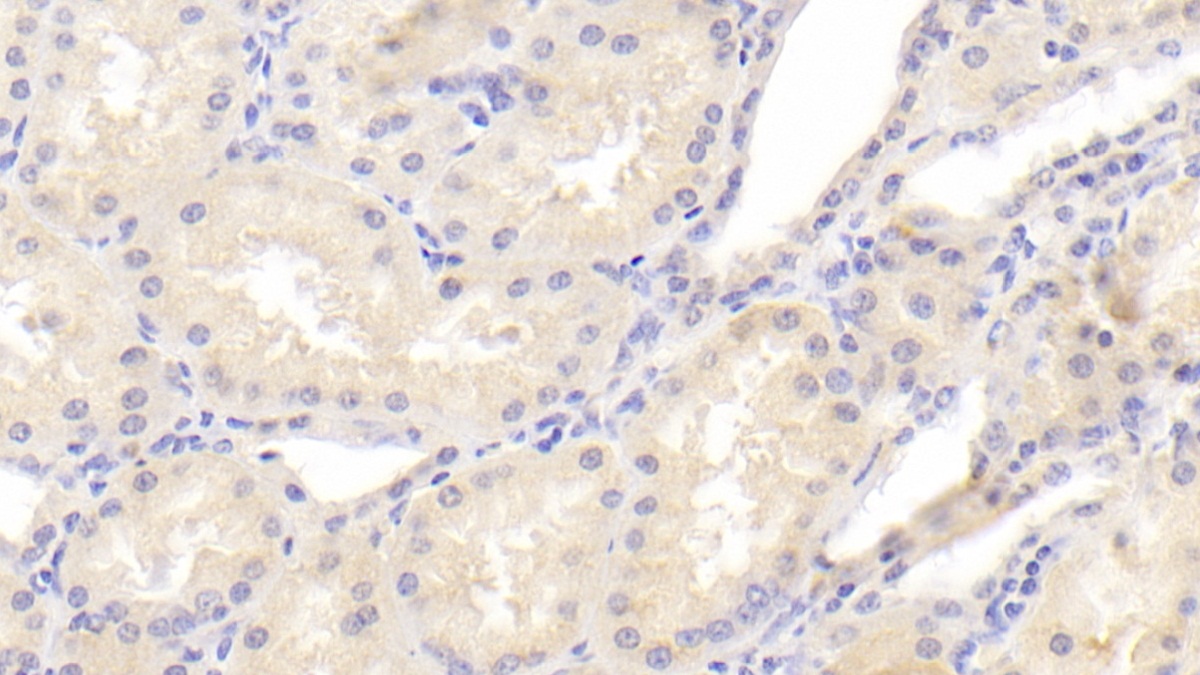 Polyclonal Antibody to Pericentrin (PCNT)