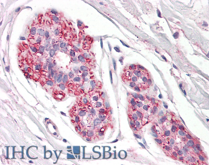 Polyclonal Antibody to Podoplanin (PDPN)