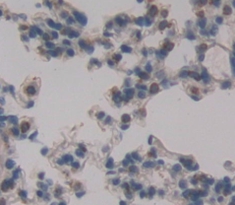 Polyclonal Antibody to Podoplanin (PDPN)