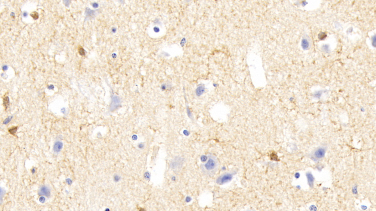 Polyclonal Antibody to Twinkle Protein, Mitochondrial (TWINL)