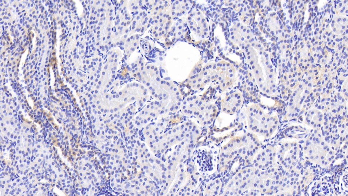 Polyclonal Antibody to Peroxisomal Biogenesis Factor 1 (PEX1)