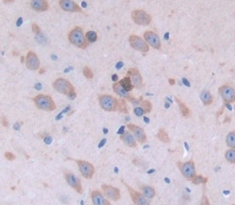 Polyclonal Antibody to Phospholipid Transfer Protein (PLTP)