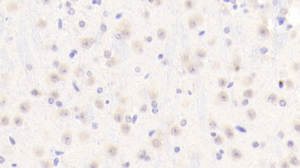 Polyclonal Antibody to Periphilin 1 (PPHLN1)