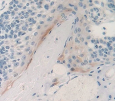 Polyclonal Antibody to Prostate Stem Cell Antigen (PSCA)