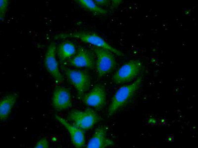 Polyclonal Antibody to Pancreas Specific Transcription Factor 1a (PTF1a)