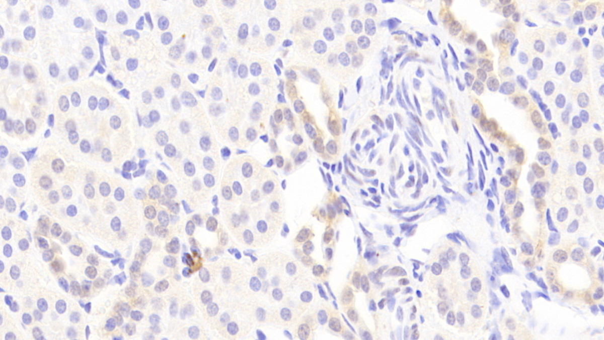 Polyclonal Antibody to Pseudouridylate Synthase 1 (PUS1)