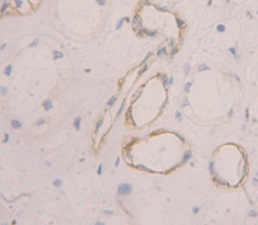 Polyclonal Antibody to Peripheral Myelin Protein 22 (PMP22)