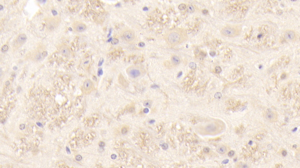 Polyclonal Antibody to Peripheral Myelin Protein 22 (PMP22)