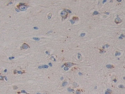 Polyclonal Antibody to Prosaposin (PSAP)