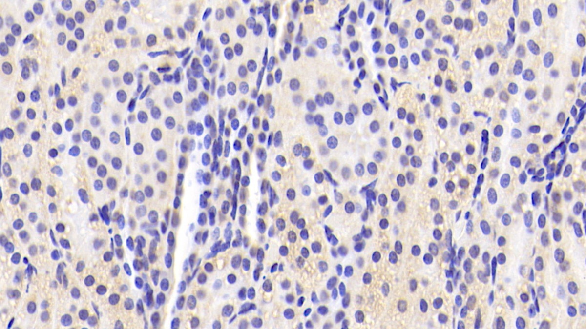 Polyclonal Antibody to Ribophorin I (RPN1)