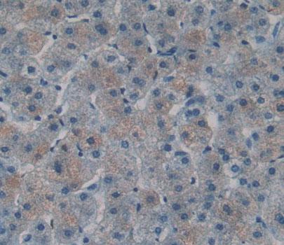 Polyclonal Antibody to T-Cell Lymphoma Invasion And Metastasis Inducing Protein 1 (TIAM1)