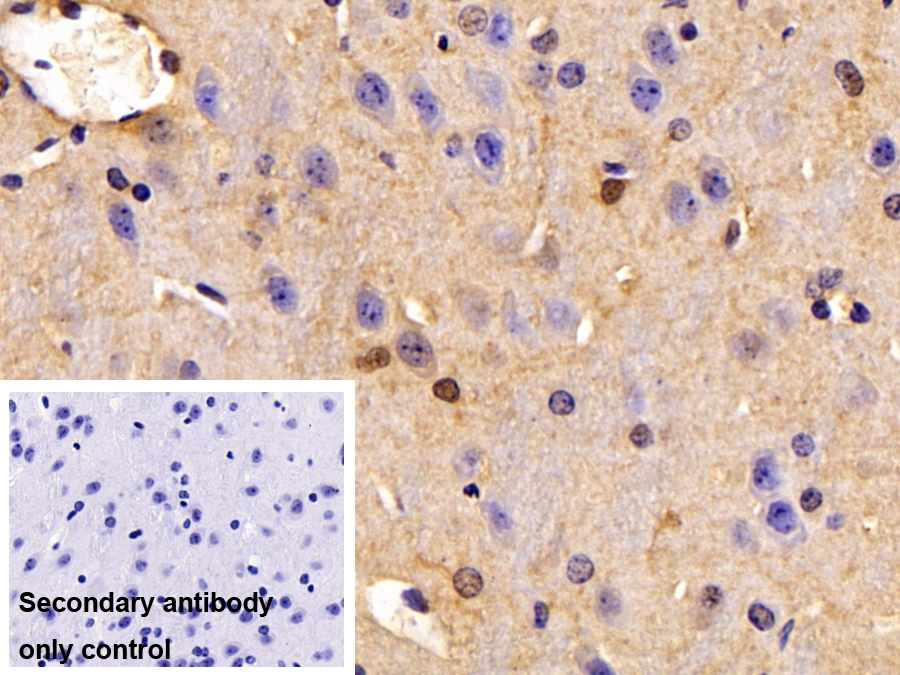 Polyclonal Antibody to Tubulin Folding Cofactor A (TBCA)