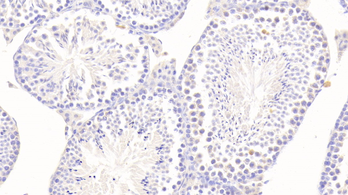 Polyclonal Antibody to Testis Specific Kinase 1 (TESK1)