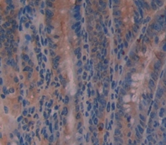 Polyclonal Antibody to Transmembrane Protease, Serine 2 (TMPRSS2)