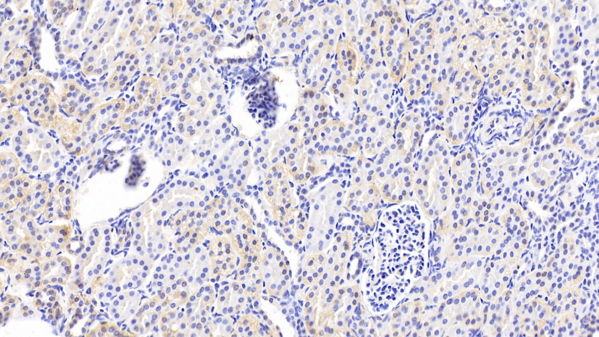 Polyclonal Antibody to Tensin 1 (TNS1)