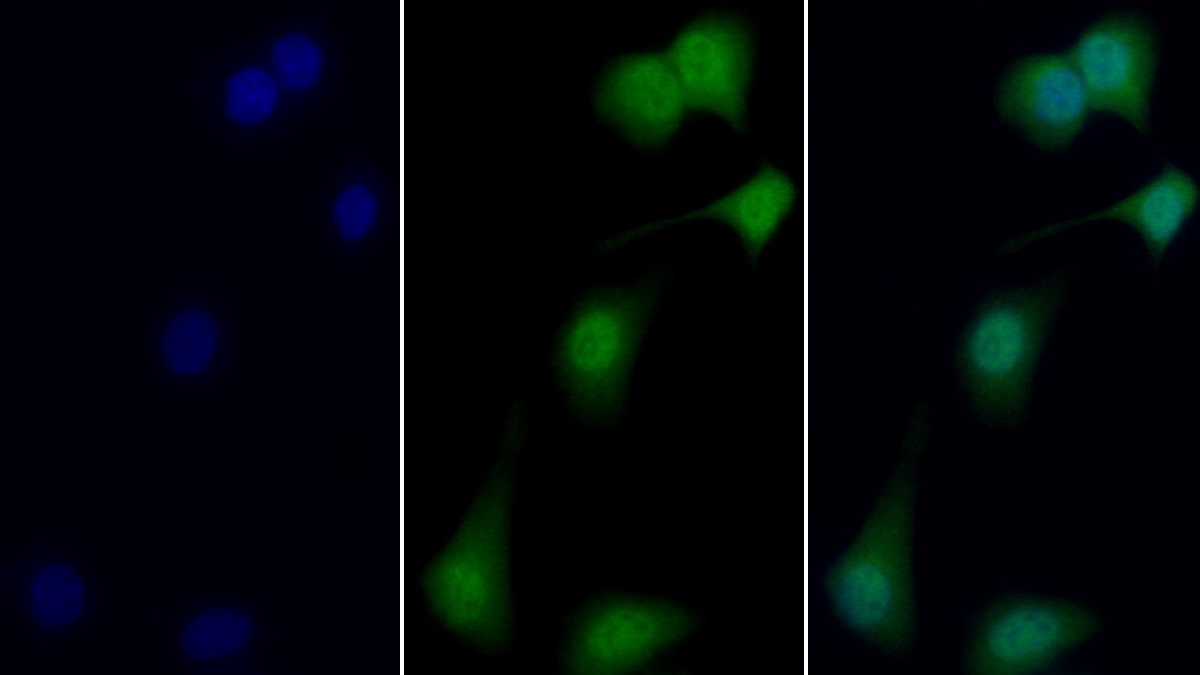 Polyclonal Antibody to Three Prime Repair Exonuclease 1 (TREX1)