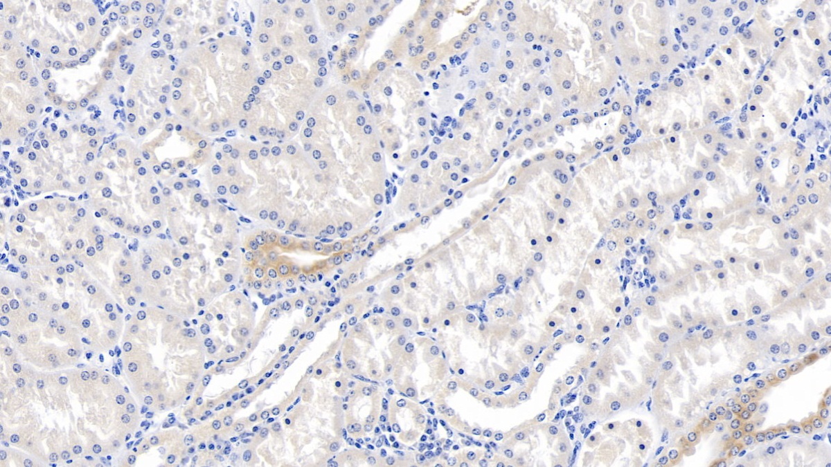 Polyclonal Antibody to Tuberous Sclerosis Protein 1 (TSC1)